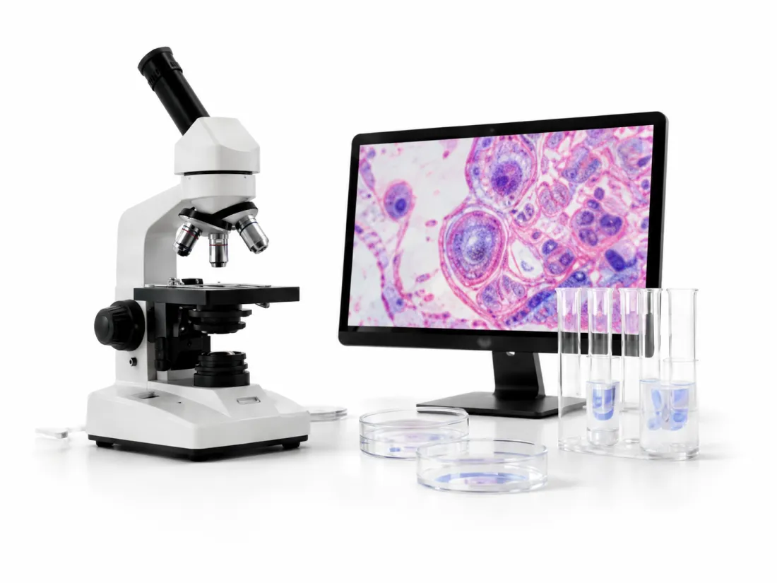 A laboratory microscope beside a monitor showing stained cell tissue, with culture dishes and sample tubes